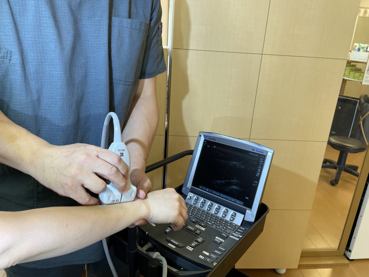 超音波エコー検査